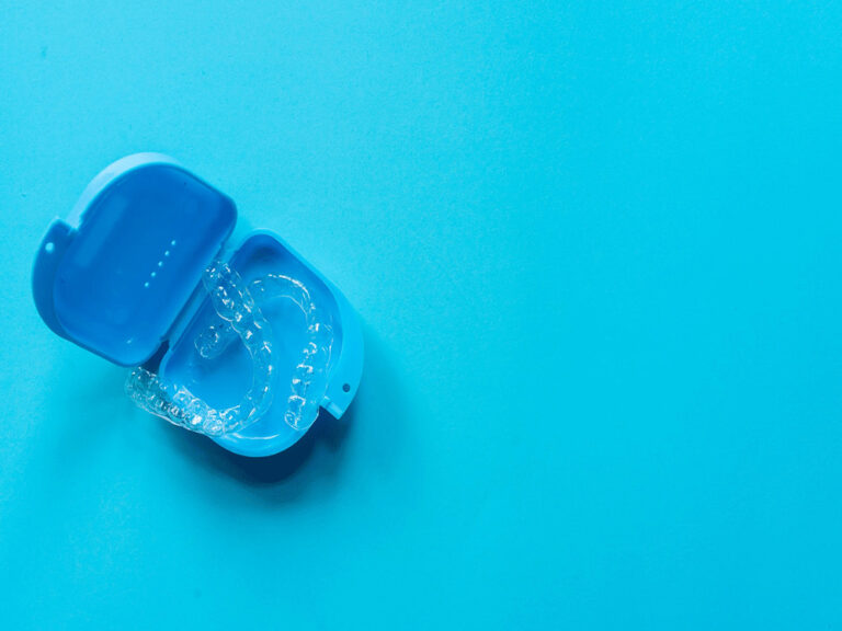 invislaign aligners in a portable blue case on a light blue background