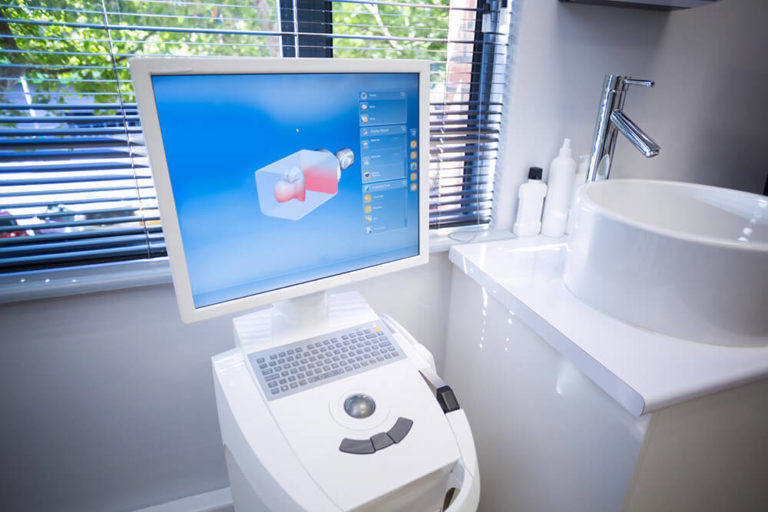 picture of an itero digital scanner in a dental office