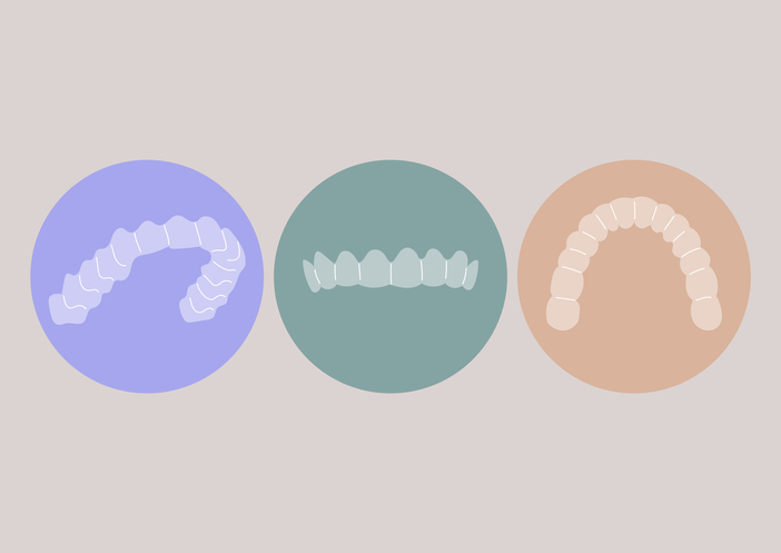 graphic of aligners in different positions