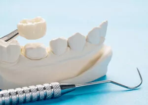 jaw model with a dental tool on a light blue background